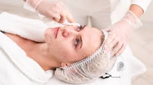 Best Acne Solutions: Effective Treatments and Natural Remedies