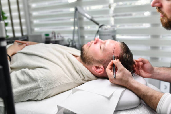 زراعة الشعر في دبي للنساء: علاجات مُخصصة لنتائج طبيعية Hair transplant in Dubai